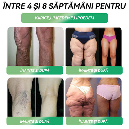 🏆Au mai rămas doar 5 cutii! Profită acum de încă 50% reducere! Recapătă-ți silueta și sănătatea! Dacă ratezi această oportunitate acum, la anul s-ar putea să fie prea târziu! 💥🔥